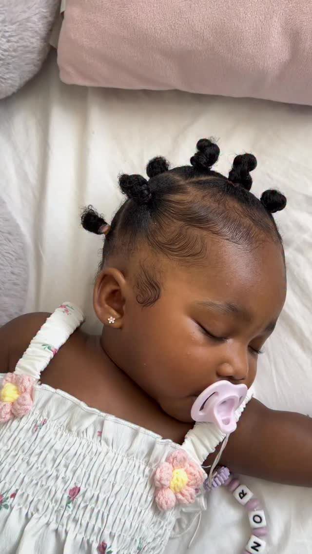 Infant with several small twisted knots across the top of the head